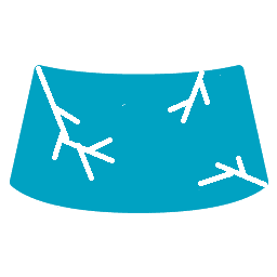 Windshield-replacement